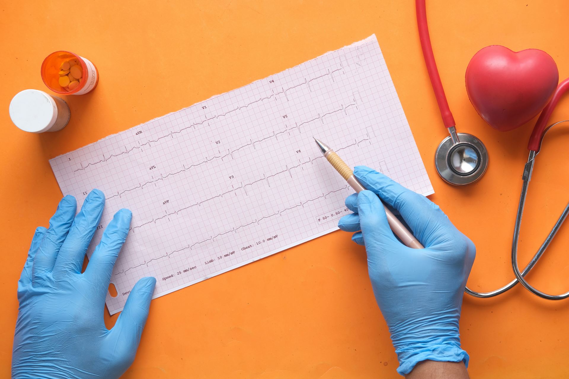 ecg reading